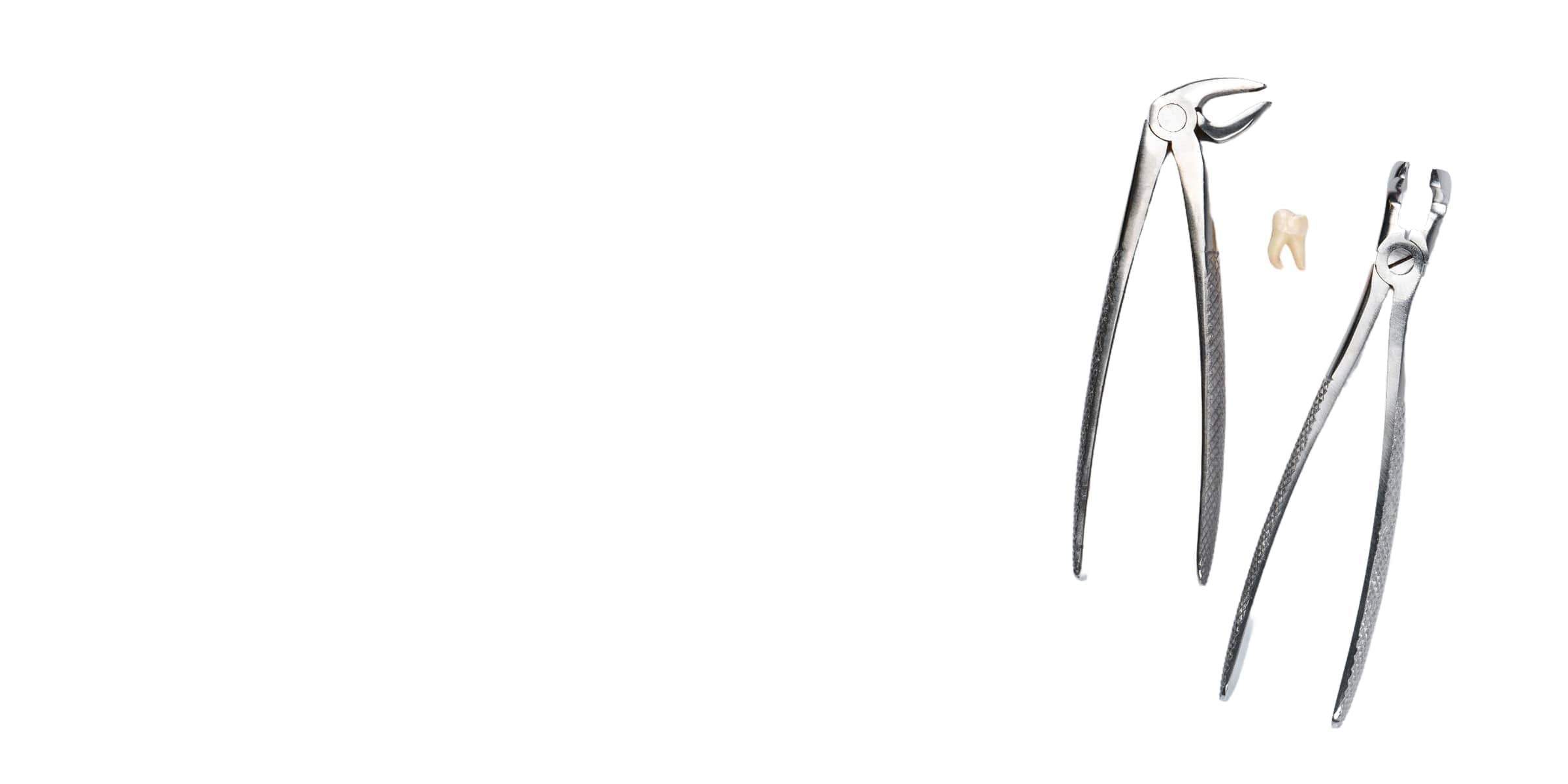 Екстракция на зъби