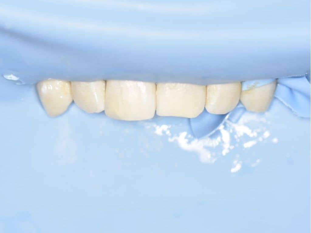 След лечение